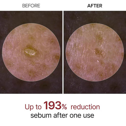 Lemnis Dr. Melaxin™️ Rice Peel Shot Ampoule